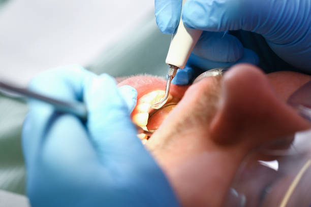 Best Emergency Treatment for Dental Infections or Abscesses in Mulgee, OK