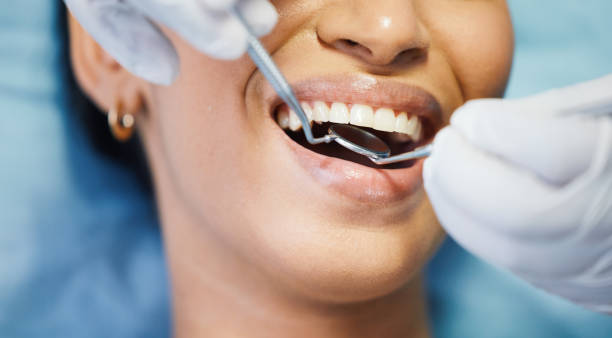 Best Emergency Tooth Extraction in Mulgee, OK