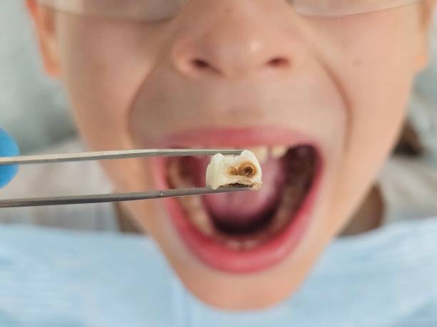 Best Emergency Denture Repair in Mulgee, OK