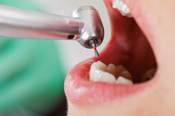 Best Emergency Root Canal Treatment in Mulgee, OK